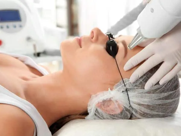 depilazione definitiva sopracciglia con laser