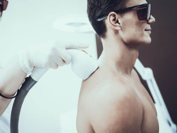 depilazione laser uomo schiena