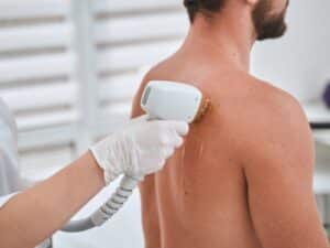 depilazione spalle uomo