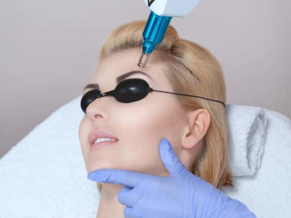 eliminare peli sopracciglia con laser