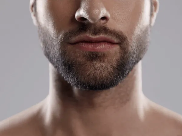 uomo con barba curata e linea del collo definita dopo trattamento di epilazione laser