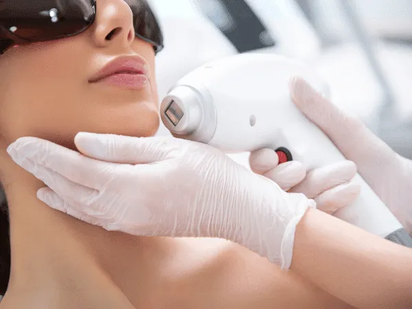 epilazione laser mento