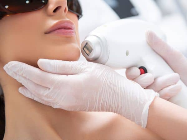 laser su viso per epilazione