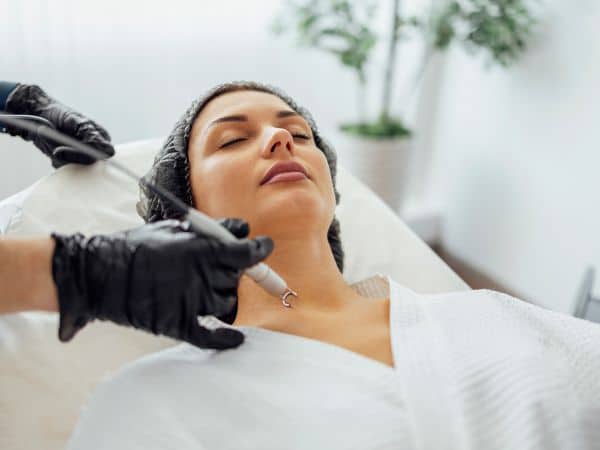 laser neodimio yag su volto di ragazza