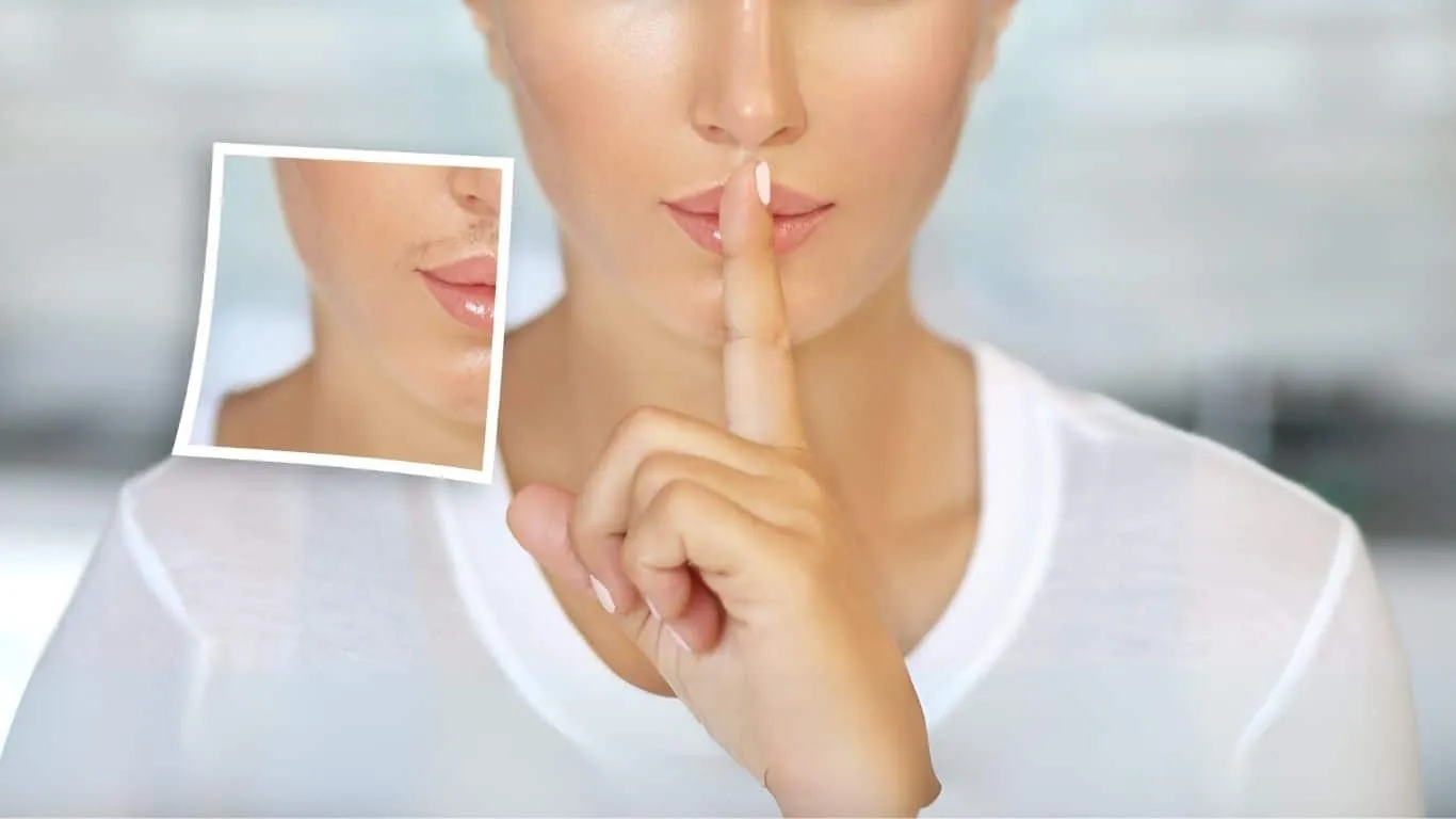laser per baffetti e peluria