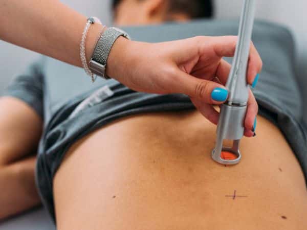 trattamento di laser neodimio yag per fisioterapia